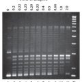 Vaccinia DNA Topoisomerase I