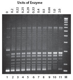 http://www.epibio.com/images/default-source/product-page-images/g_recaprotein_relaxation.jpg?sfvrsn=0.2066586172142849