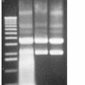 RNase I