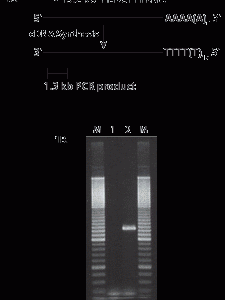 MMLV Reverse Transcriptase
