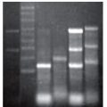 mRNA-ONLY™ Prokaryotic mRNA Isolation Kit with Poly(A)-Tailing