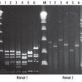 Lambda Terminase
