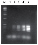 http://www.epibio.com/images/default-source/product-page-images/g_failsafe_multiplexpcr.jpg?sfvrsn=0.2517537763753005