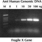 http://www.epibio.com/images/default-source/product-page-images/fragile_x.jpg?sfvrsn=0.30648153852300575