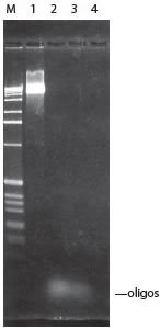 http://www.epibio.com/images/default-source/product-page-images/g_baselinezero_dnasetreatment.jpg?sfvrsn=0.40603494306581567