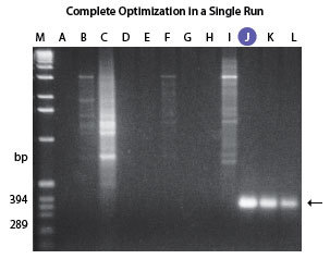 http://www.epibio.com/images/default-source/product-page-images/g_failsafe_humanfragilexgene.jpg?sfvrsn=0.5304707492556441